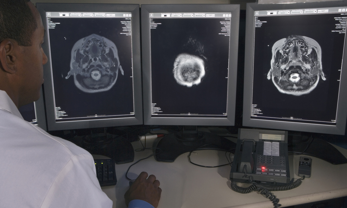 Male physician looking at brain scans on three vertical screens